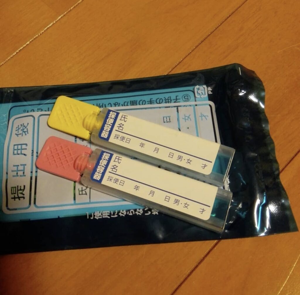 検便キット どこで買える, 検便キット ダイソー セリア 販売, 検便キット 通販と実店舗 比較, 検便キット 購入方法 レビュー, 検便キット 販売店 2025 最新情報